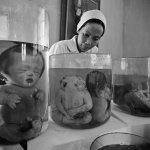 At Tu Du hospital in Hi Chi Minh City, Philip Jones Griffiths finds a nurse examining the affects of US military herbicide spraying in his book Agent Orange - Collateral Damage in Viet Nam. Photo: Philip Jones Griffiths